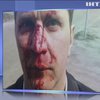В Киеве на пороге медучреждения жестоко избили врача