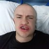 Сломали челюсть и выбили зубы: под Харьковом подрались детские тренеры (видео)