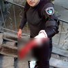 Под Киевом с ножом напали на сотрудника Департамента охраны