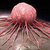 Возникновение рака: ученые назвали неожиданную причину