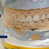 Смерть в стоматологическом кресле после введения анестезии: халатность клиники или несчастный случай?