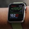 Apple Watch спасли жизнь мужчины во сне 