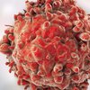 Ученые нашли способ борьбы с неизлечимым раком 
