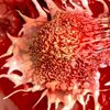 Опасный рак можно предотвратить: ученые назвали способ