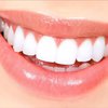 Какие продукты сильно вредят зубам 