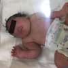 В Ираке родился ребенок без носа (фото)