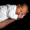 Медики изучили деформацию черепа младенца при родах