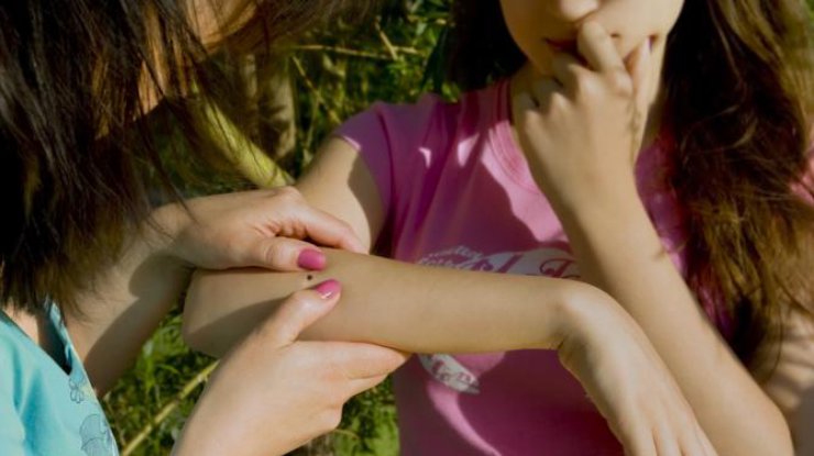 Что делать, если ребенка укусил клещ \ фото: comode.kz