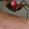 Как оказать помощь при укусе паука