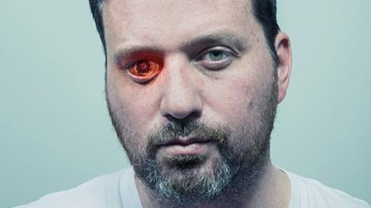 Мужчина заменил потерянный глаз/ Фото: The Eyeborg Project 