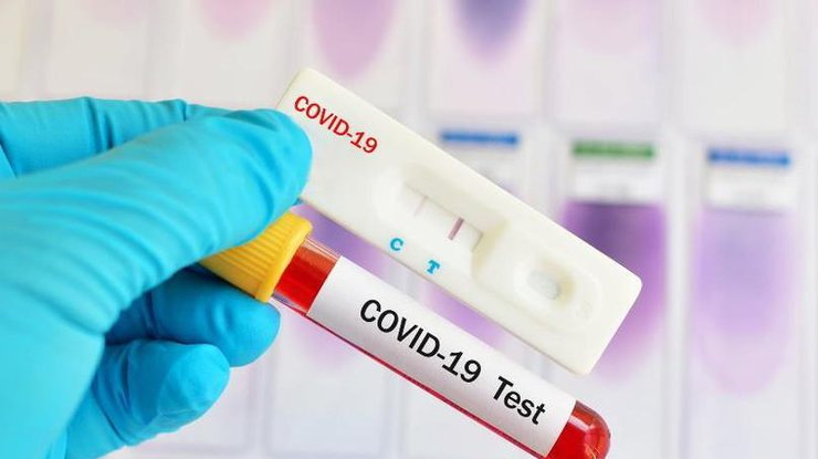 Словакия проведет массовое тестирование населения на коронавирус/Фото: vogazeta
