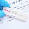 Разработан самый дешевый и надежный тест на коронавирус
