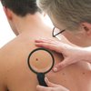 Как определить рак кожи: названы главные симптомы