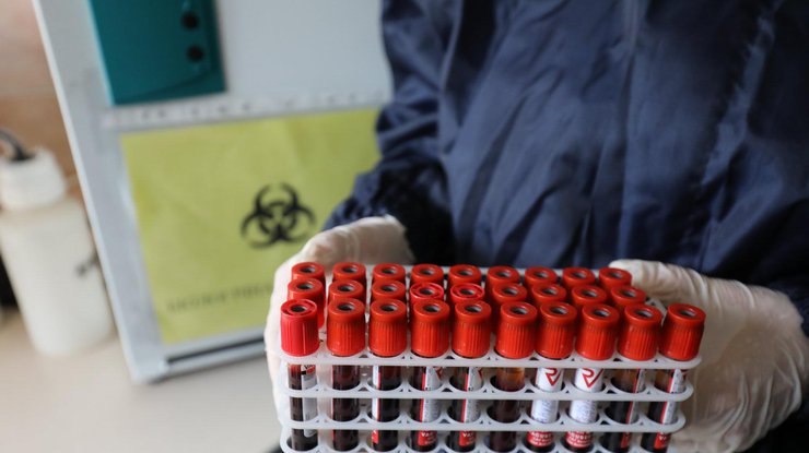 Чехия лидирует по числу умерших от коронавируса на 100 тысяч жителей