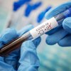 В Словакии провели рекордное коронавирусное тестирование