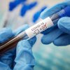 В Украине проведут "словацкое" тестирование на коронавирус