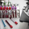 "Миллион флаконов": Австралия начала производство вакцины от COVID-19 