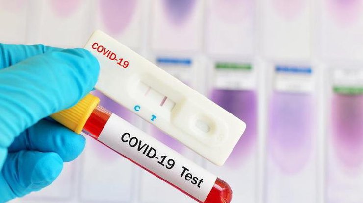 Тесты на коронавирус/ Фото: vogazeta.ru