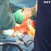 В інституті Шалімова провели унікальні операції з трансплантації органів