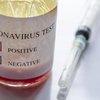 Когда Украина получит вакцину от коронавируса