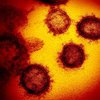 Ученые показали впечатляющие фото коронавируса
