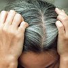 Почему волосы седеют после стресса 