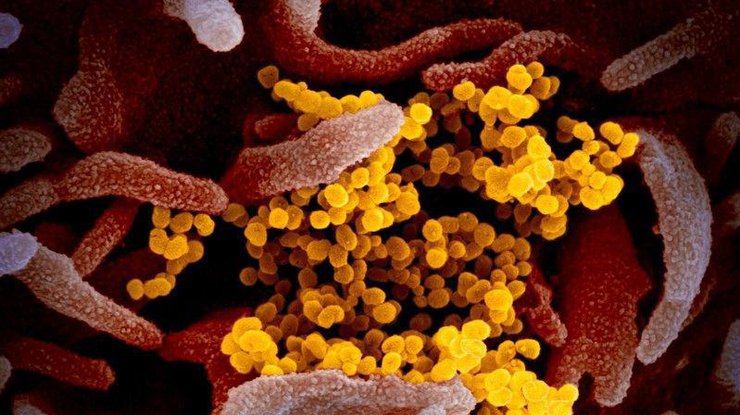 Фото коронавируса на микроскопе 
