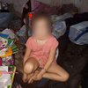 В Киеве нашли 6-летнюю девочку: условия проживания ребенка шокируют