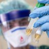 В США подтвердили первую смерть от коронавируса 