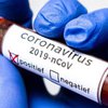 В Катаре зафиксировали первый случай коронавируса