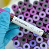 В Украине можно будет купить экспресс-тест на коронавирус
