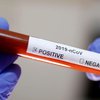 В Лондоне подтвердили коронавирус у инфицированного в Украине