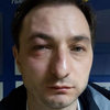 В Киеве жестоко избили главврача Национального института рака