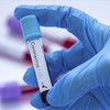 Тестирование на коронавирус в Украине будут проводить в 8 городах