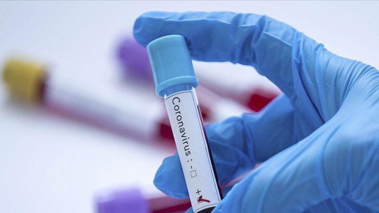 Тест на коронавирус/ Фото: trend.az