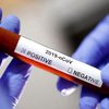 Военные обеспечены тестами на коронавирус - Минобороны