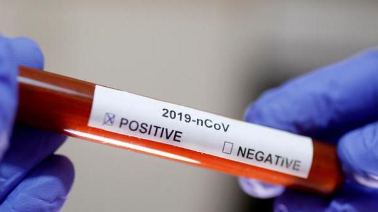 Тест на коронавирус/ Фото: REUTERS