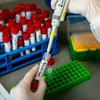 В Винницкой области подтвердили первый случай заражения коронавирусом 