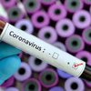 В Винницкой области увеличилось количество зараженных коронавирусом