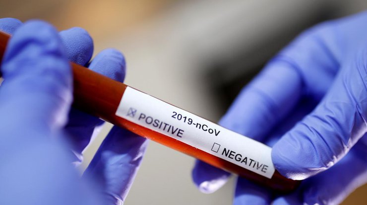 В Китае одобрили тест-систему для диагностики коронавируса/ Фото: REUTERS