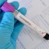 В Запорожской области зафиксировали 6 новых случаев коронавируса