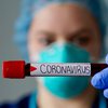 В Николаевской области число зараженных коронавирусом резко возросло 