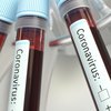 В Днепропетровской области 11 новых случаев заражения коронавирусом 