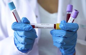 Во Львовской области зафиксировали две смерти от коронавируса 