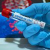 В Ривненской области зафиксировали 30 новых случаев заражения COVID-19