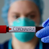 В Полтавской области подтвердили новый случай коронавируса