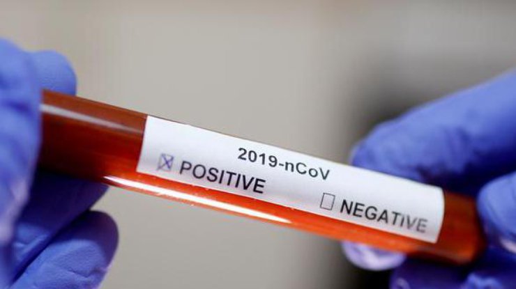 Тест на коронавирус/ Фото: REUTERS