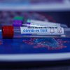 Проблемы с украинскими тестами на коронавирус: в МОЗ сделали заявление