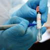Украинцы получили рекордное количество результатов "коронавирусных" тестов
