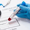 Когда в Украине завершится пик коронавируса 